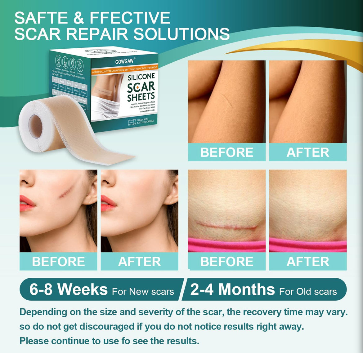 Medical Grade Silicone Scar Sheets, Silicone Scar Tape (1.6”X 120”), Professional Scar Removal Treatment, Reusable Silicone Scar Strip For Keloid, C-Section, Surgery, Burns, Acne Etc