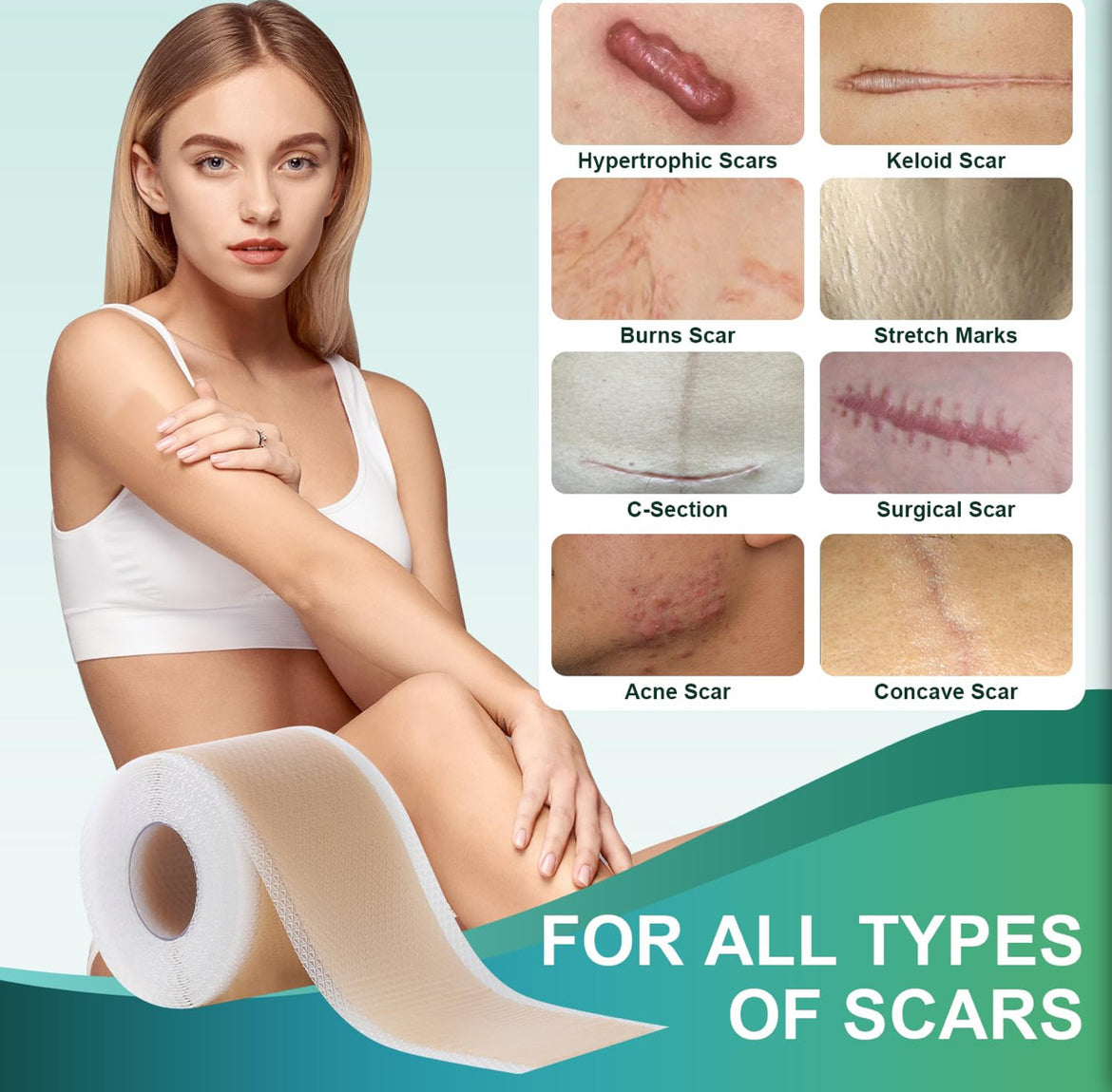 Medical Grade Silicone Scar Sheets, Silicone Scar Tape (1.6”X 120”), Professional Scar Removal Treatment, Reusable Silicone Scar Strip For Keloid, C-Section, Surgery, Burns, Acne Etc
